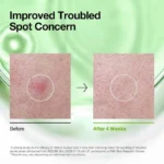 Anua Azelaic Acid 3+ Cica Skin Clarifying Toner (250ml) - Image 5