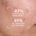 Bioderma Sebium Gel Moussant Purifying Cleansing Foaming Gel (200ml) - Image 3