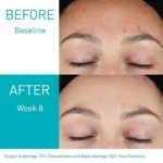 CeraVe Resurfacing Retinol Serum (30ml) - Image 3