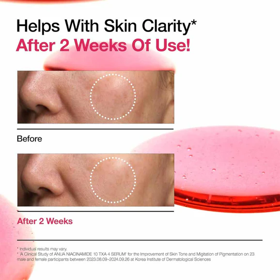 Anua Niacinamide 10% + TXA 4% Serum (30ml) - Image 5