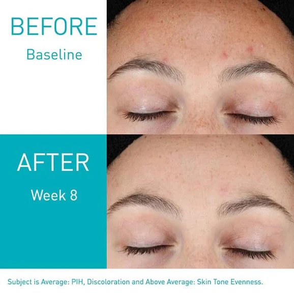 CeraVe Resurfacing Retinol Serum (30ml) - Image 3